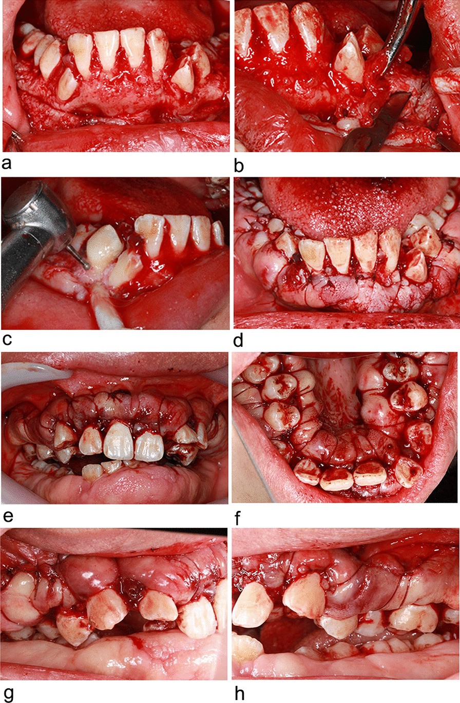 Fig. 4