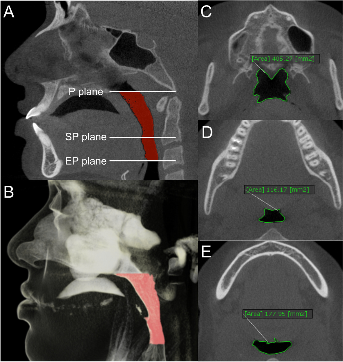 Fig. 4