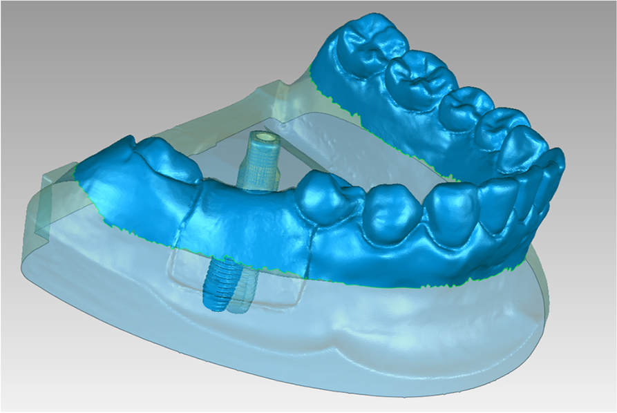 Fig. 11