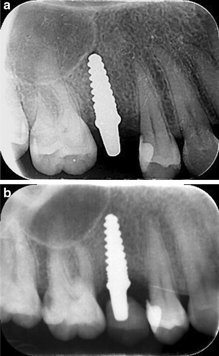 Fig. 10