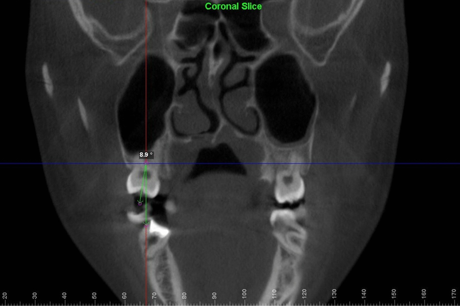 Fig. 3