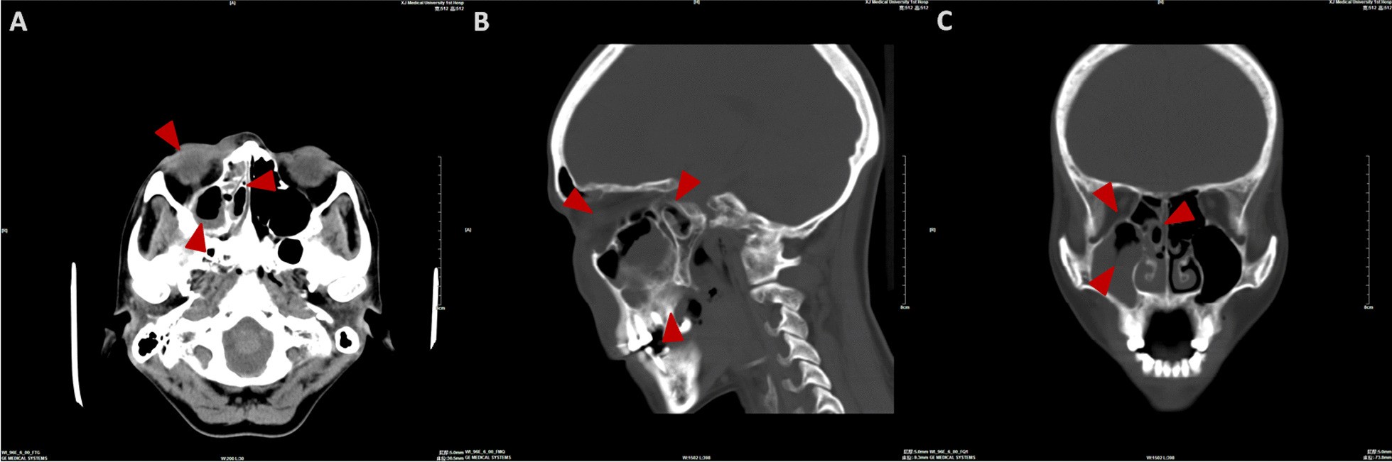 Fig. 2