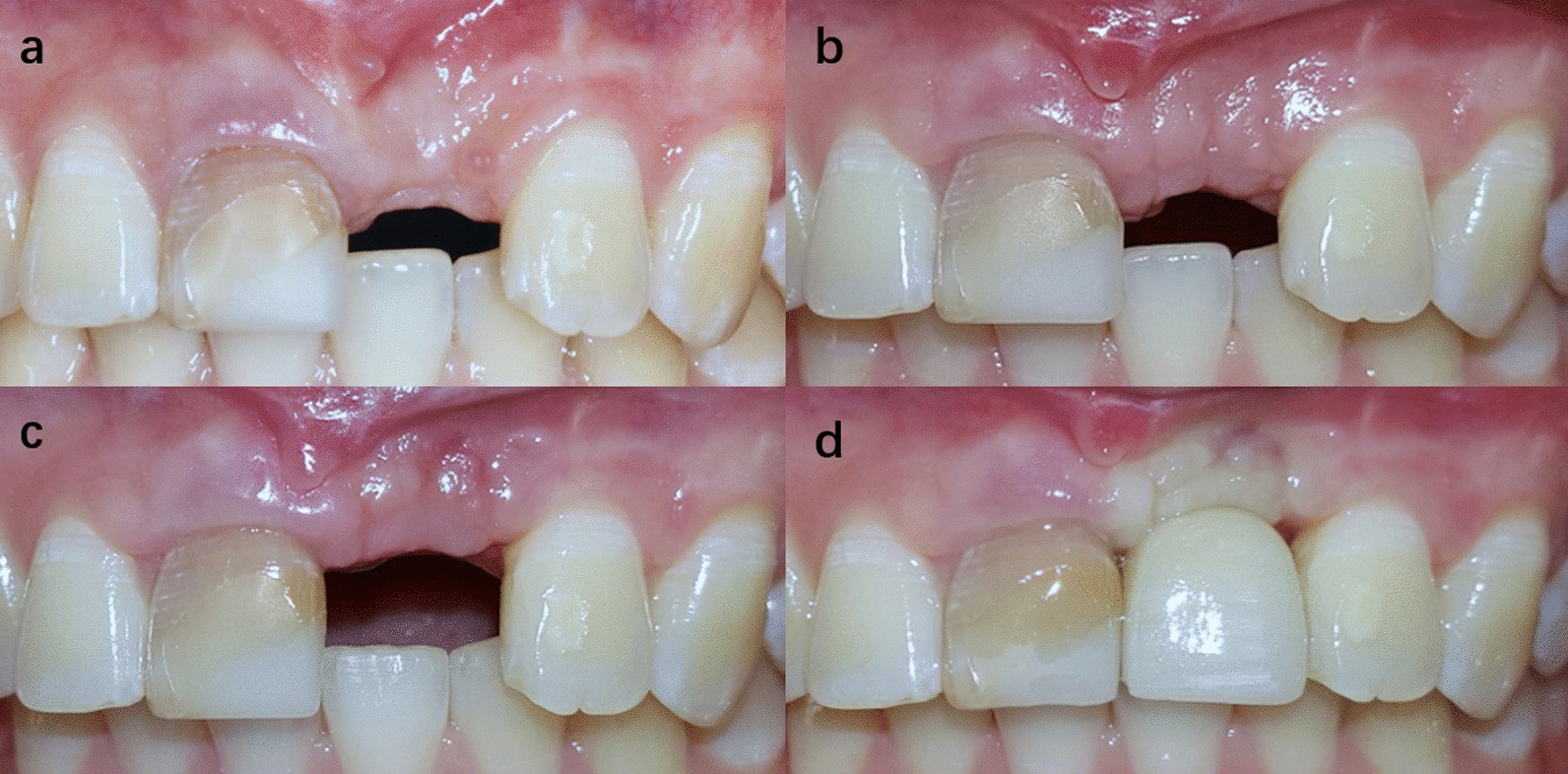 Fig. 5