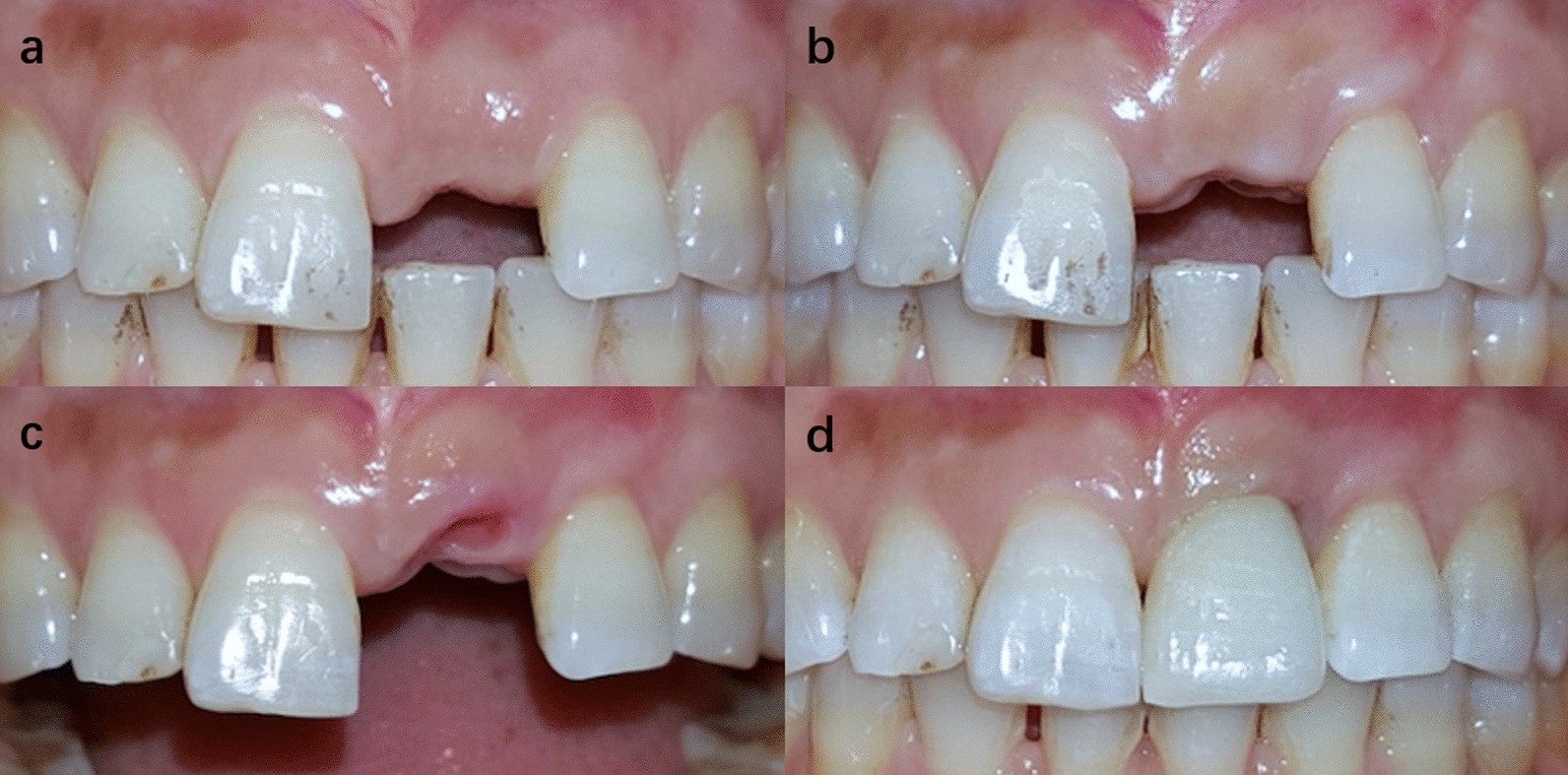 Fig. 7