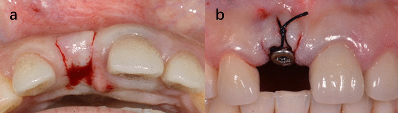 Fig. 9