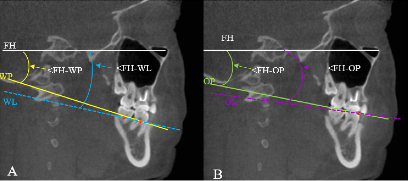 Fig.3