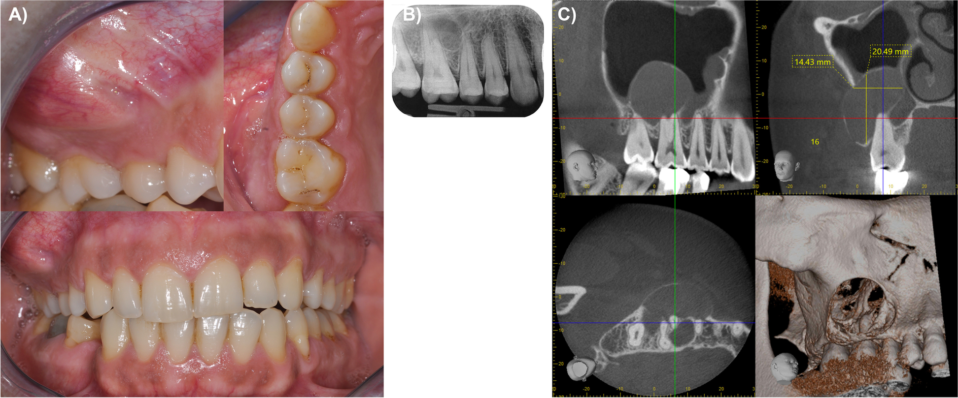 Fig. 1