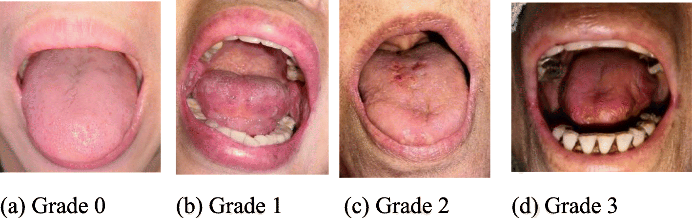 Fig. 3