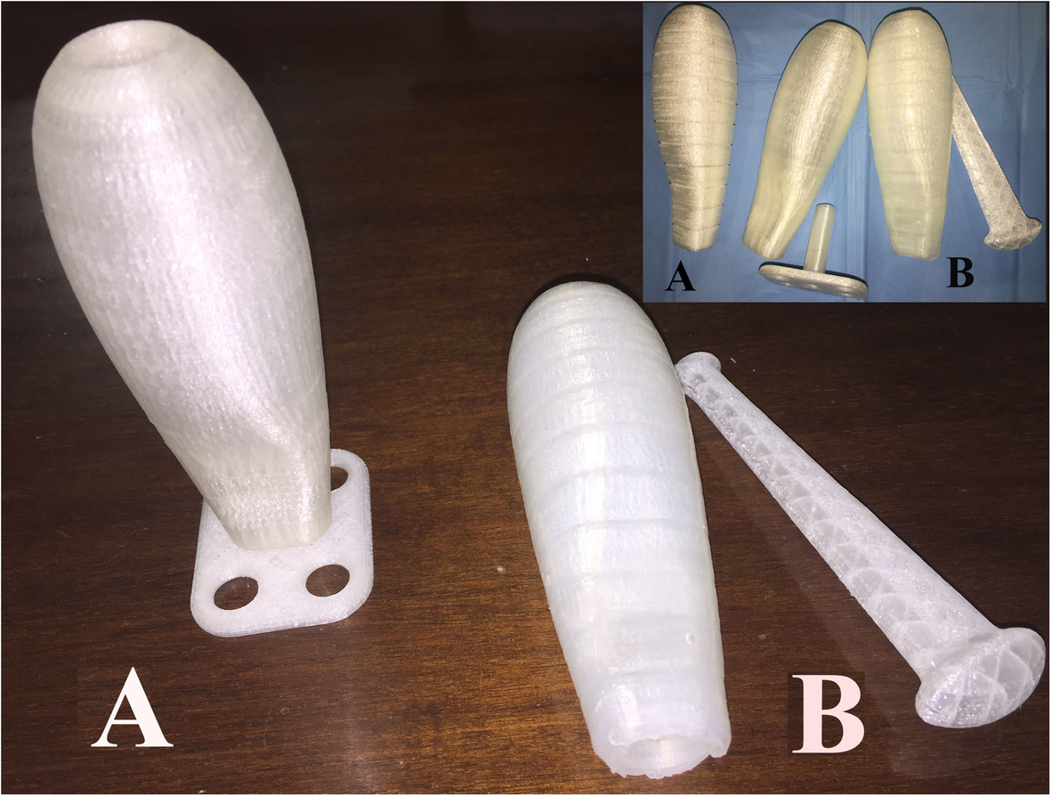 Clinical pilot study to evaluate the neovaginal PACIENA prosthesis® for  vaginoplasty without skin grafts in women with vaginal agenesis, BMC  Women's Health