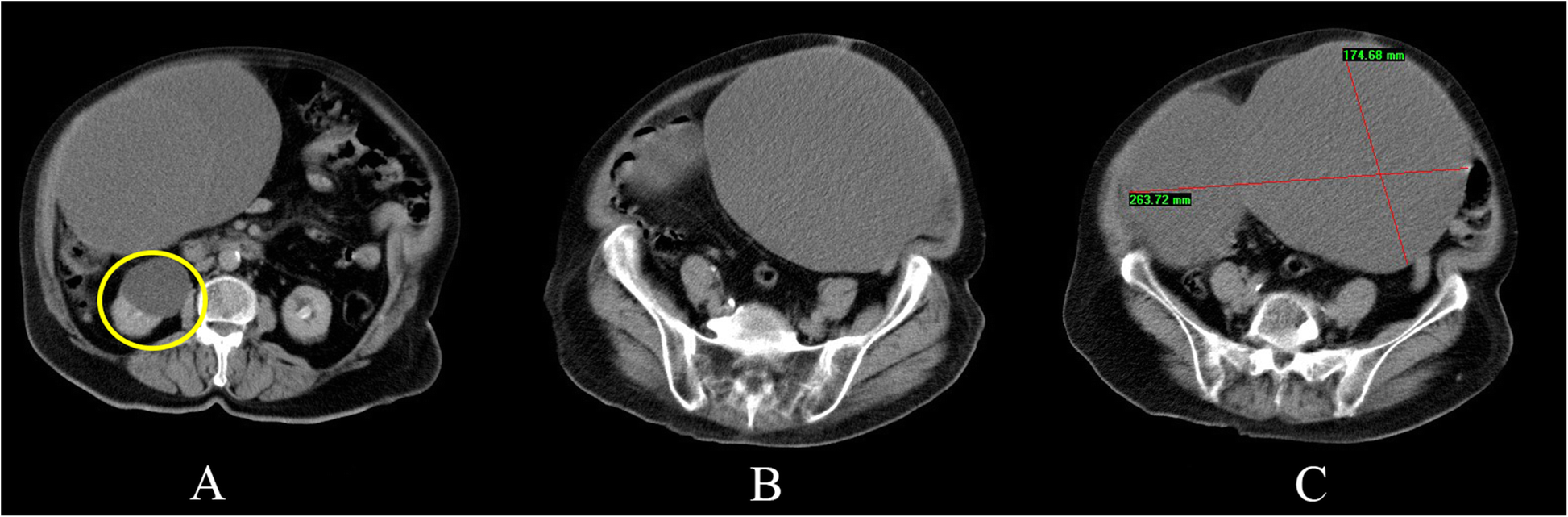 Fig. 1