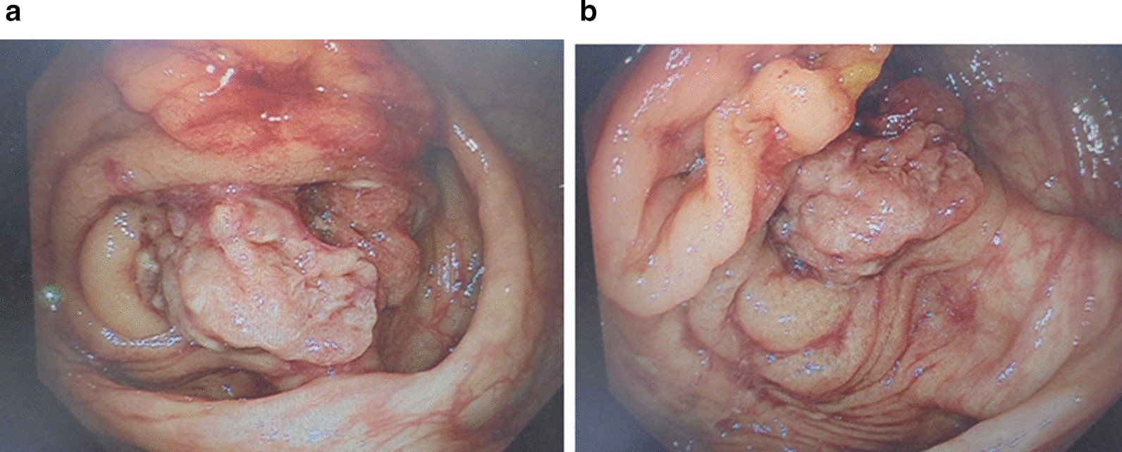 Fig. 3