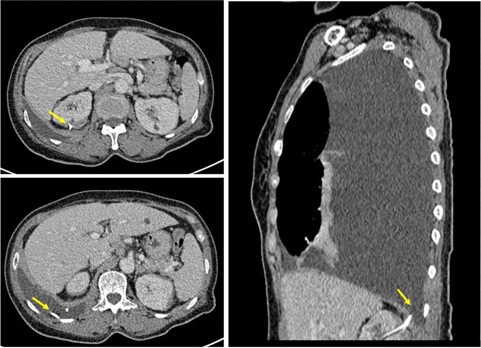 Fig. 3