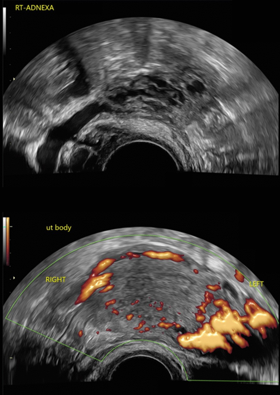 Fig. 1