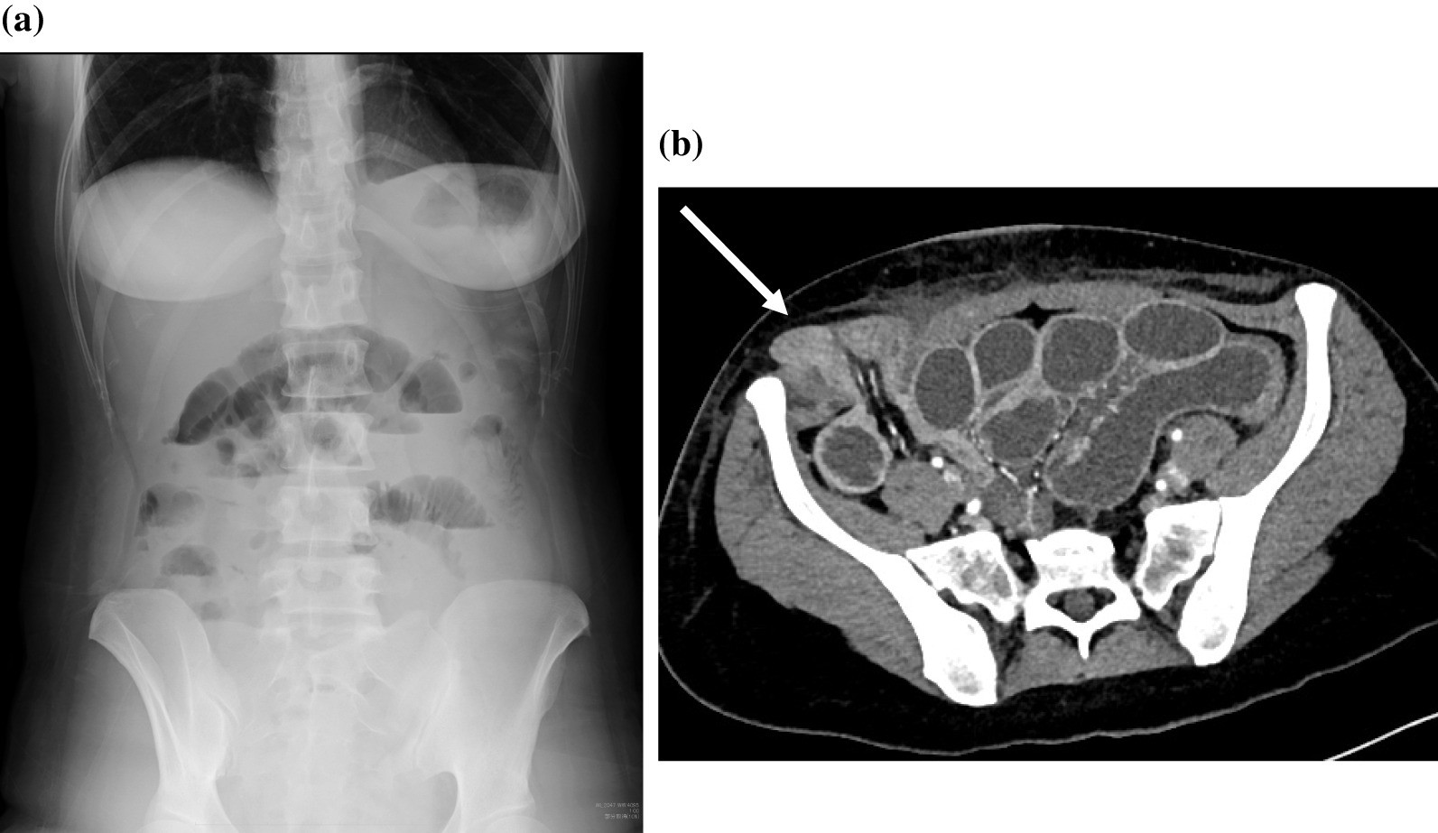 Fig. 4