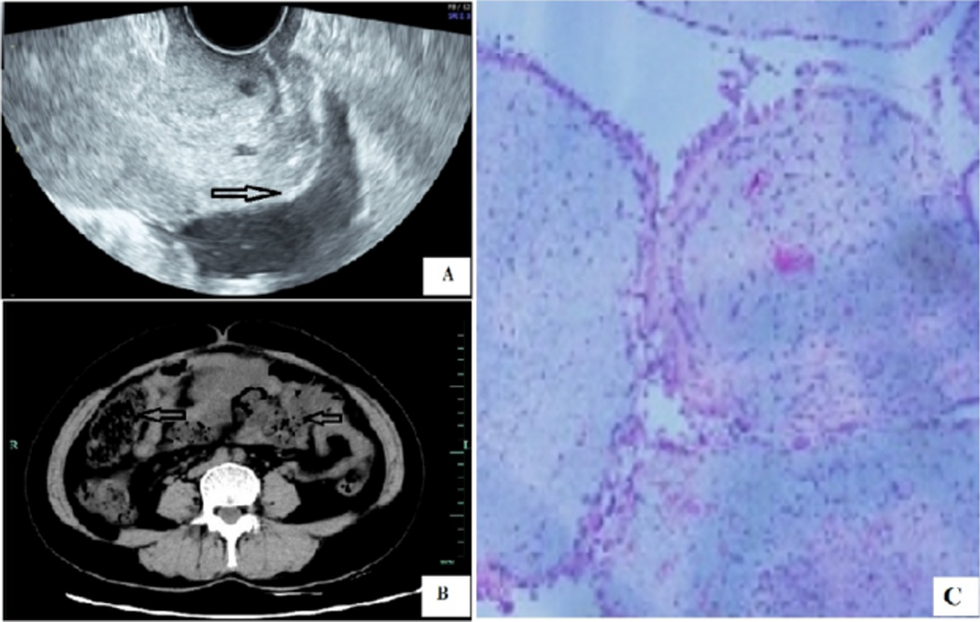 Fig. 1