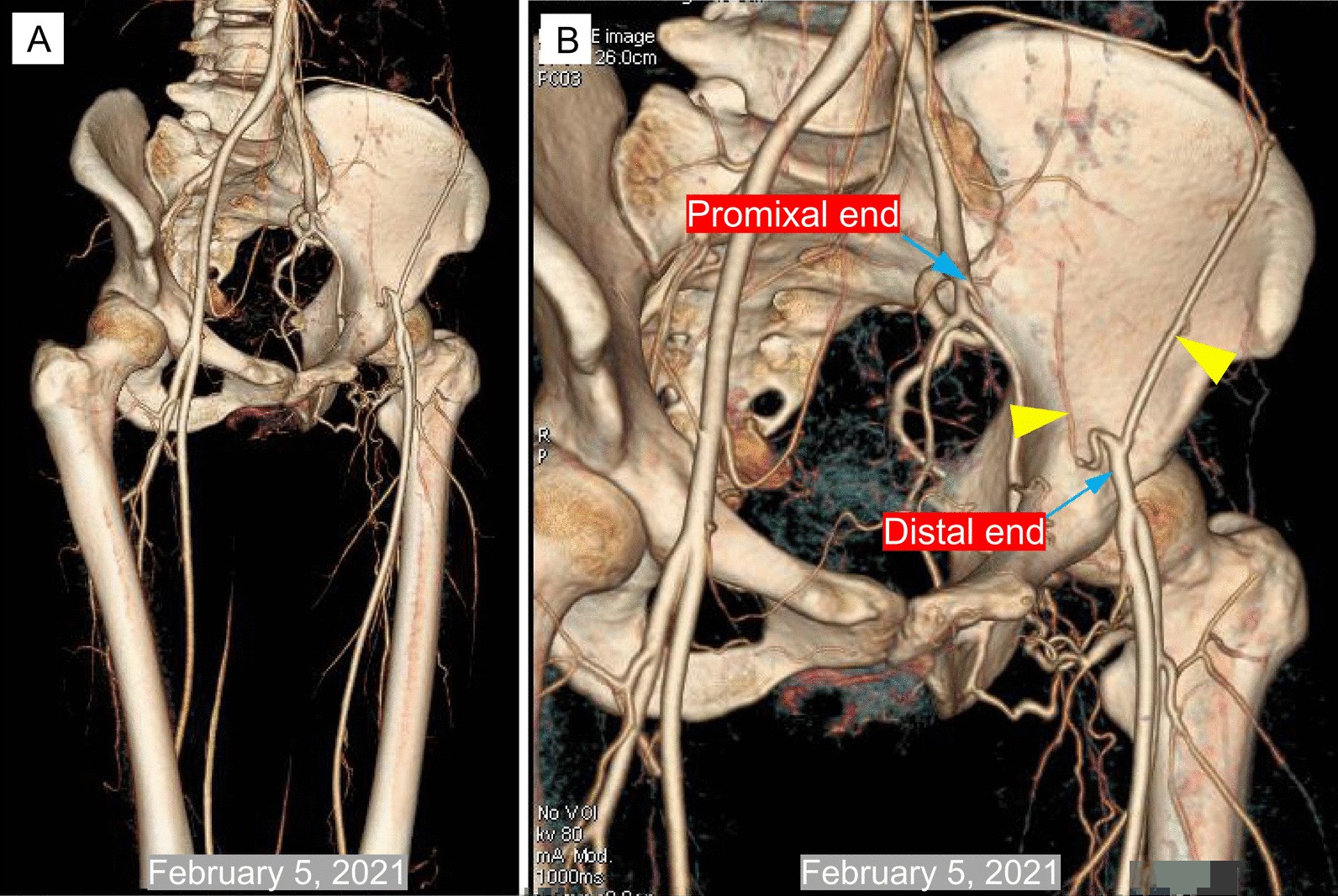 Fig. 4