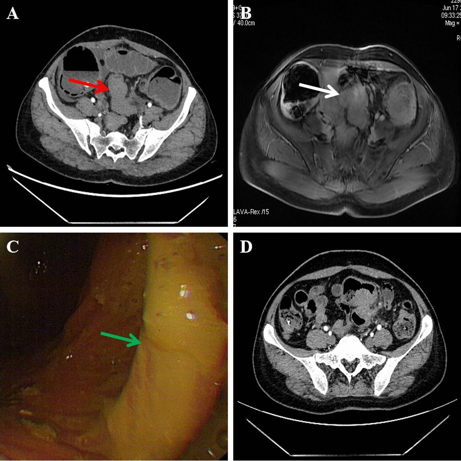 Fig. 1