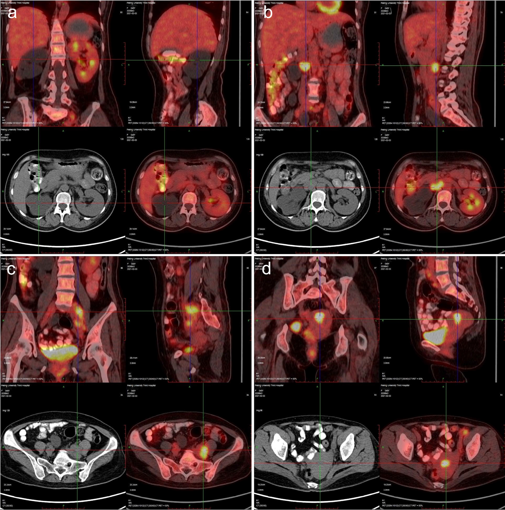 Fig. 2