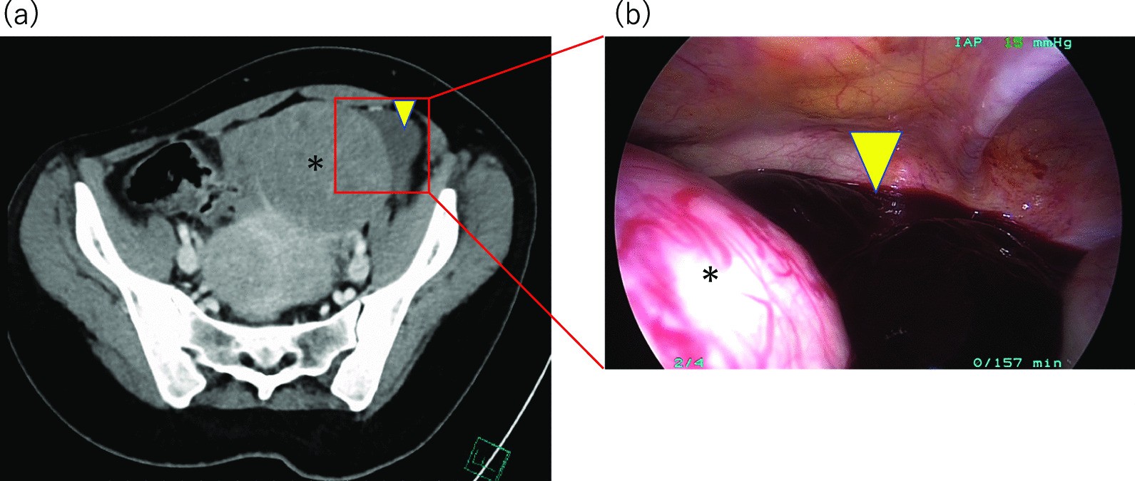 Fig. 1