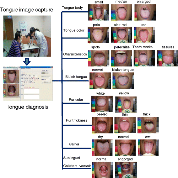 Fig. 1