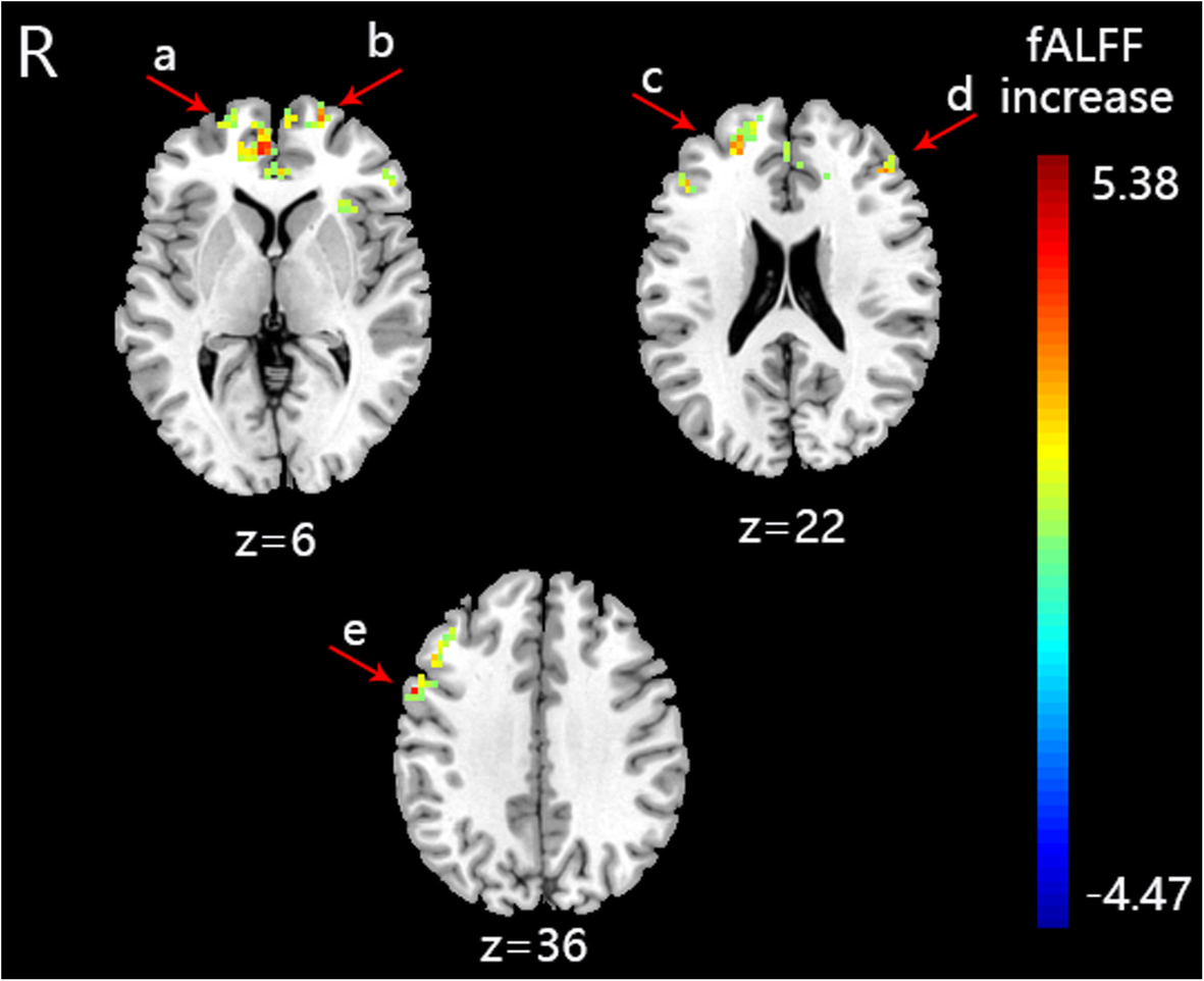 Fig. 4