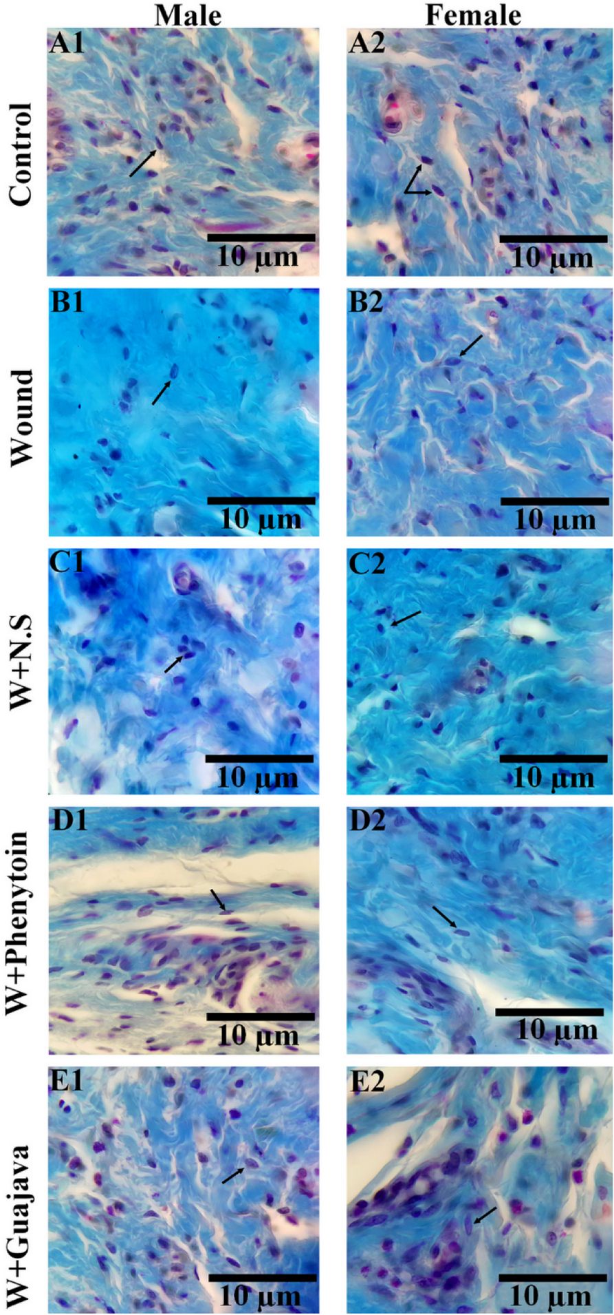 Fig. 12