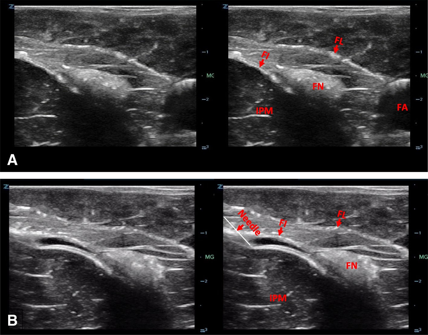 Fig. 11