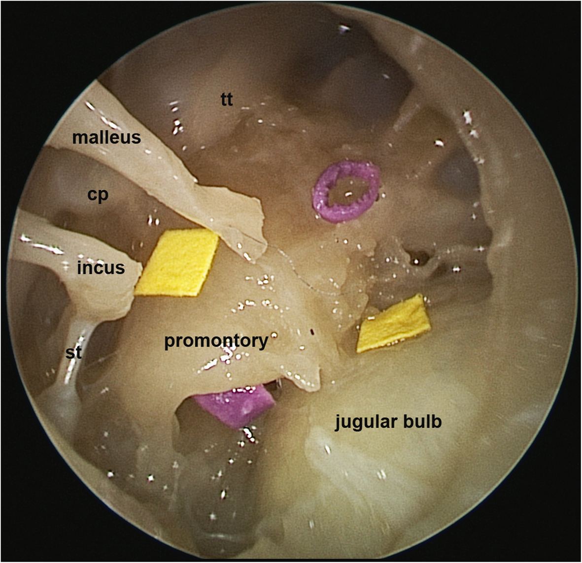 Fig. 2