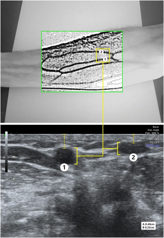 Figure 4