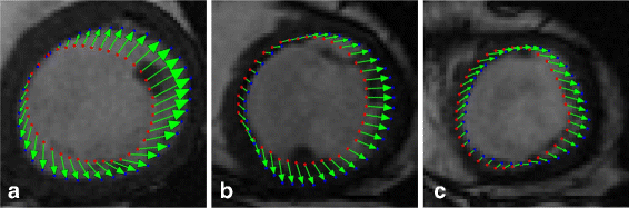 Fig. 13