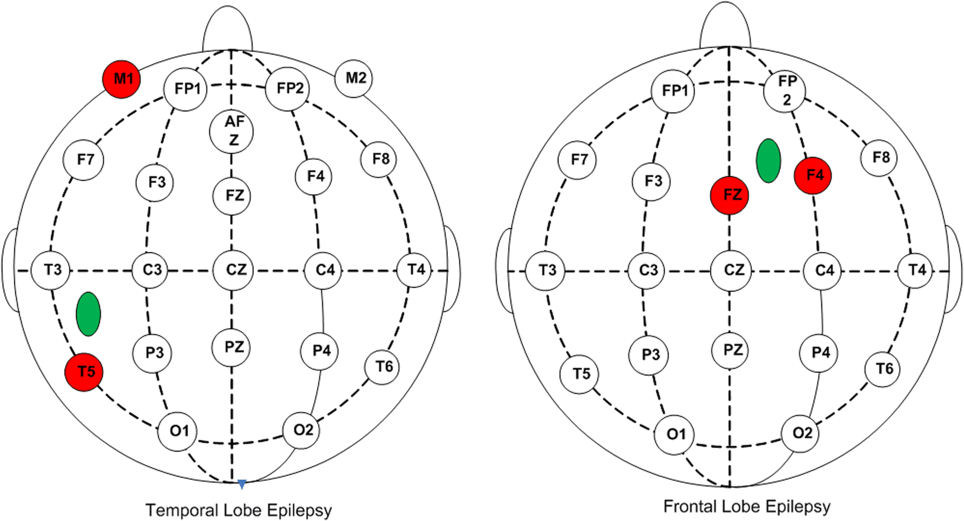 Fig. 4