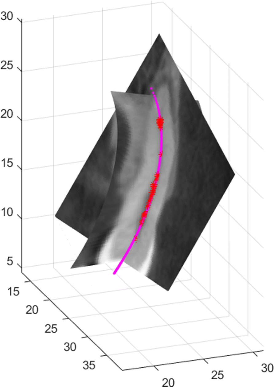 Fig. 17