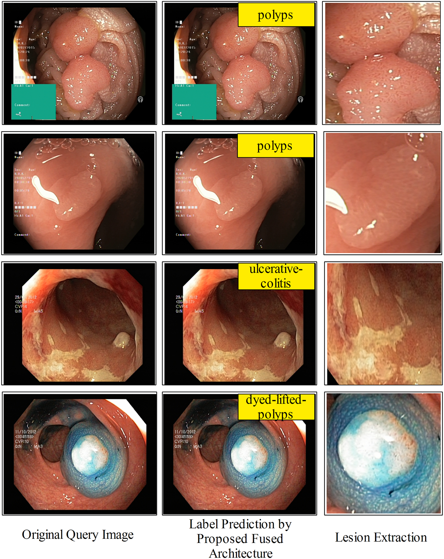 Fig. 14