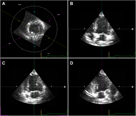 Fig. 2