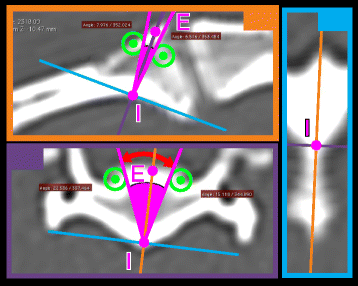 Fig. 3