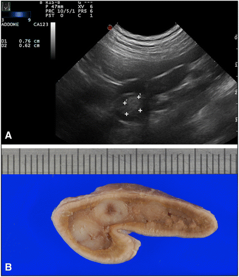 Fig. 5