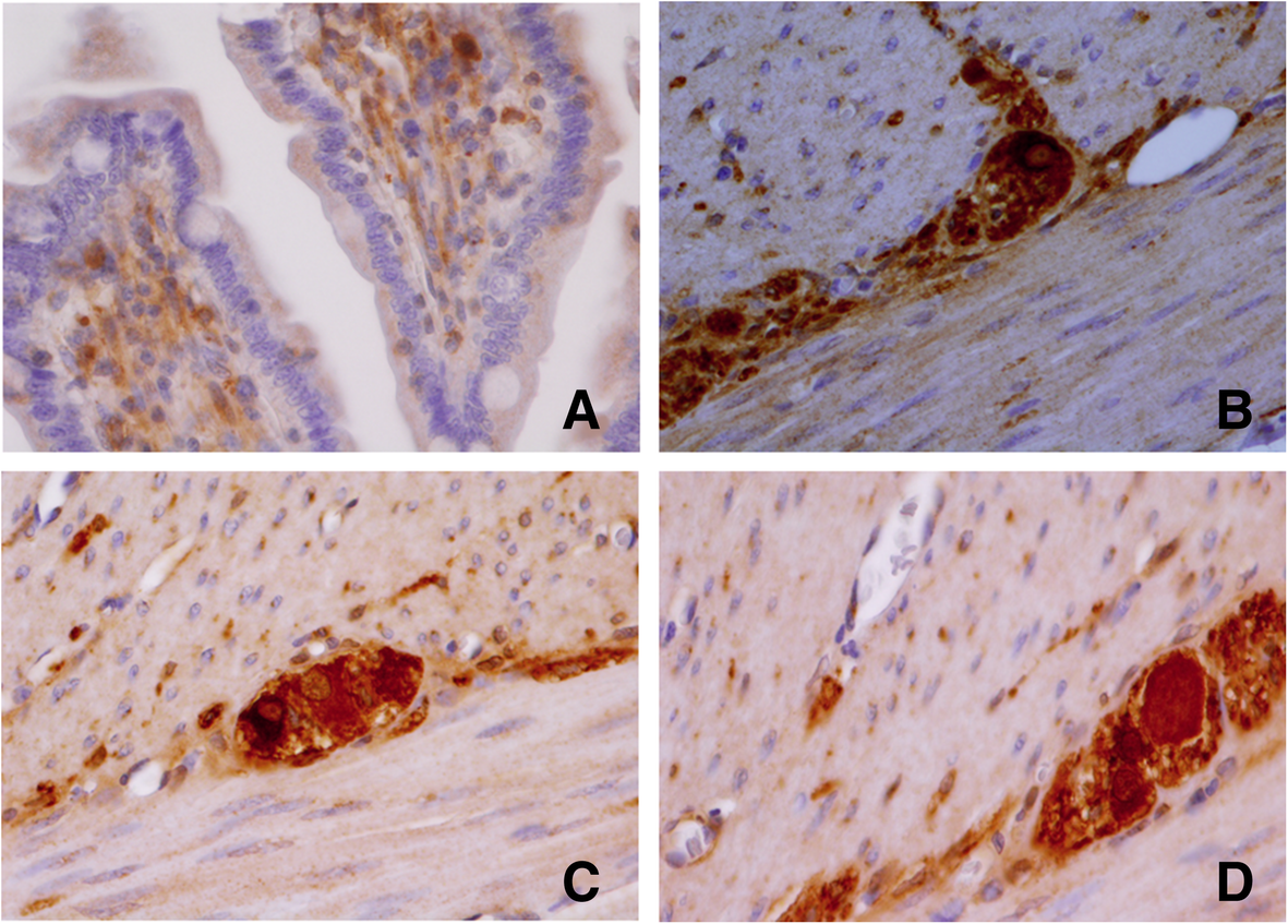 Fig. 11