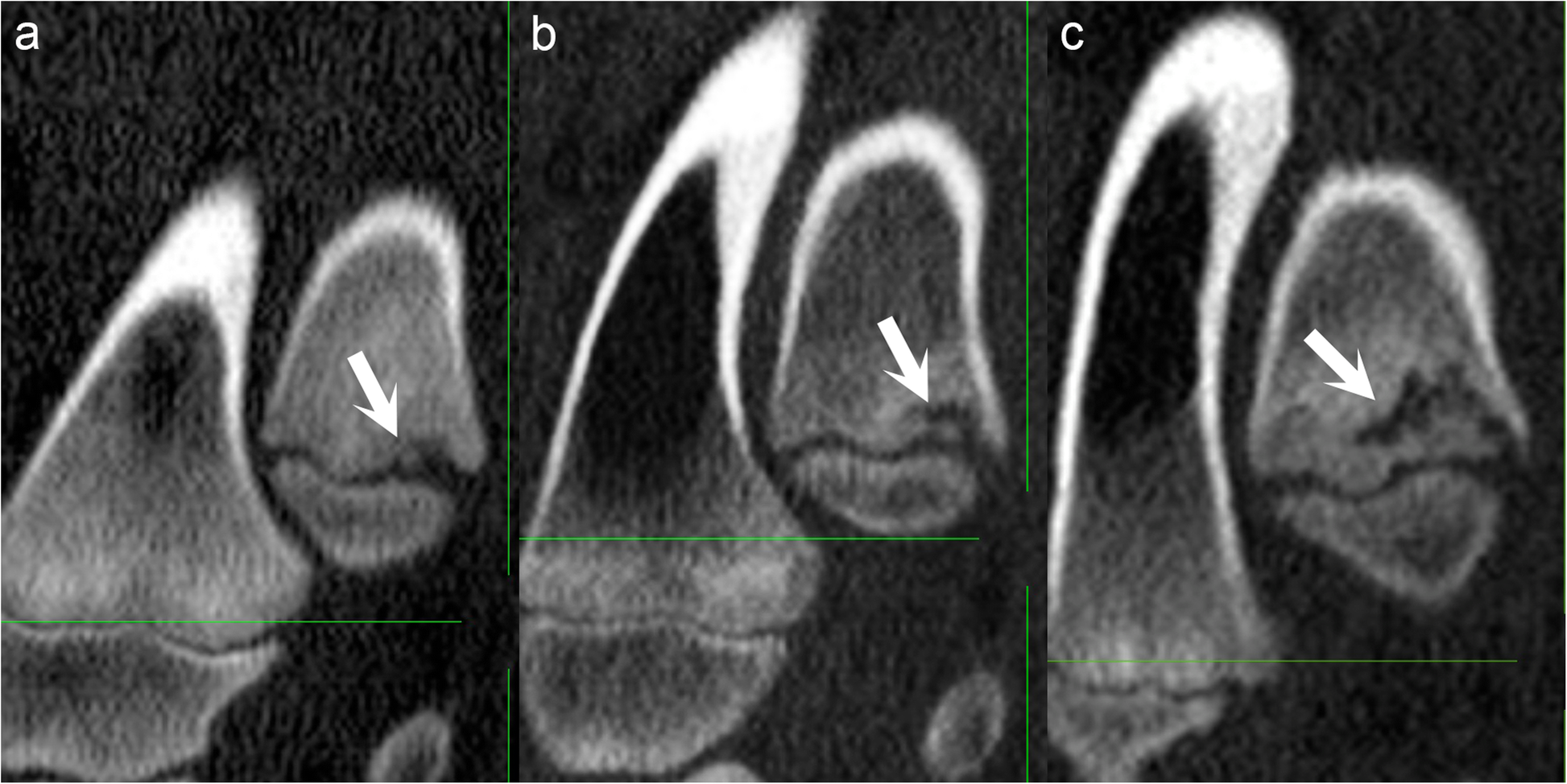 Fig. 5