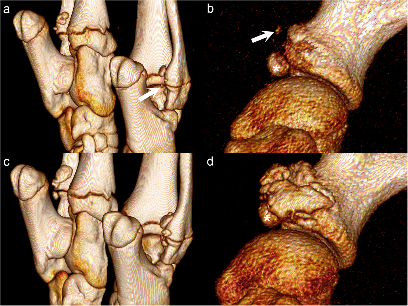 Fig. 6