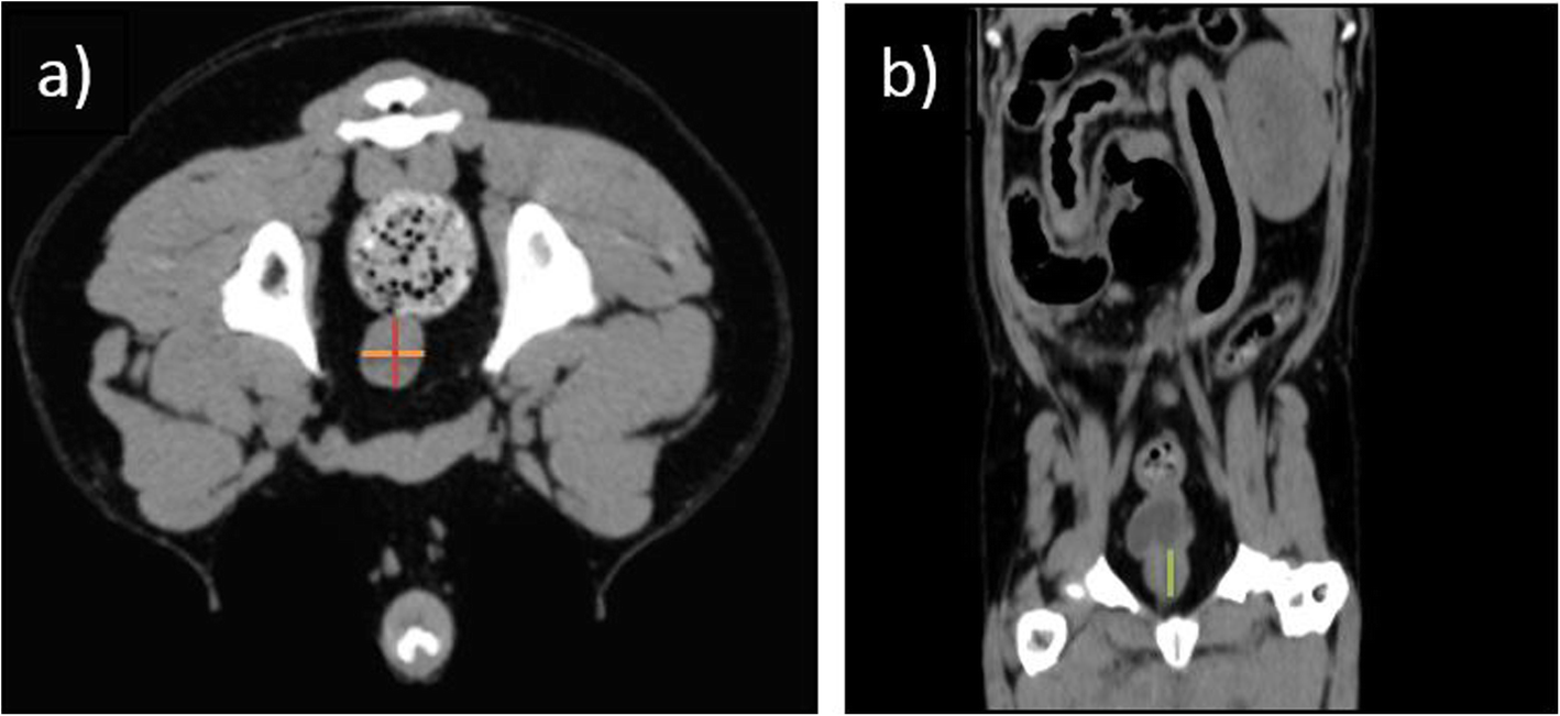 Fig. 5