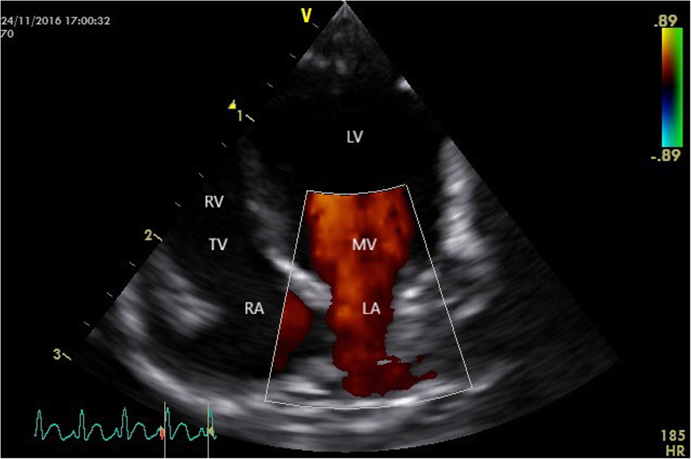 Fig. 10