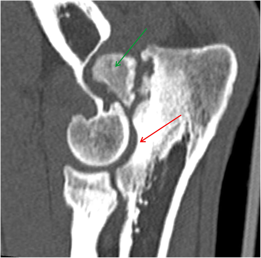 Fig. 10