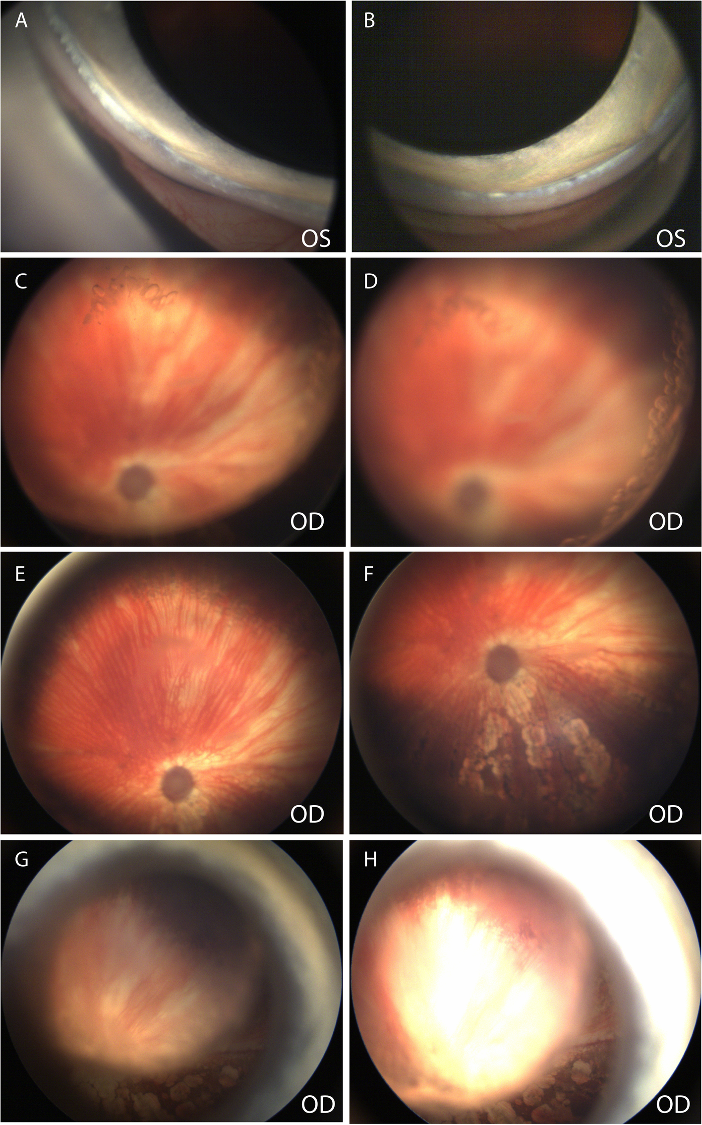 Fig. 12