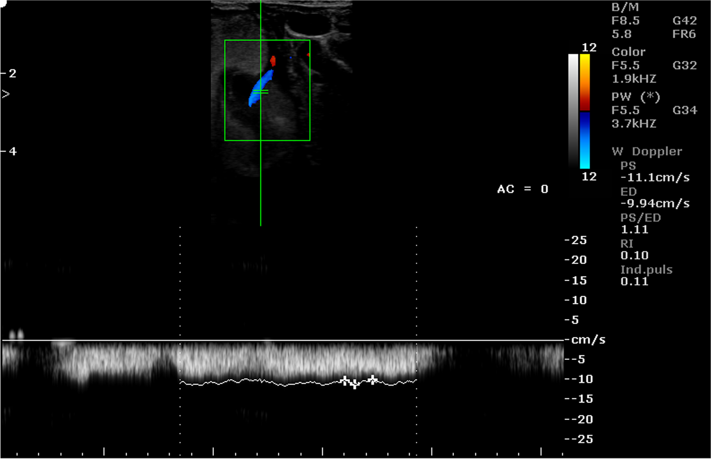 Fig. 11