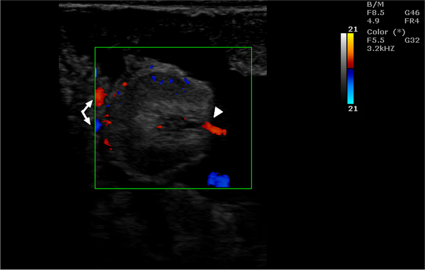 Fig. 13