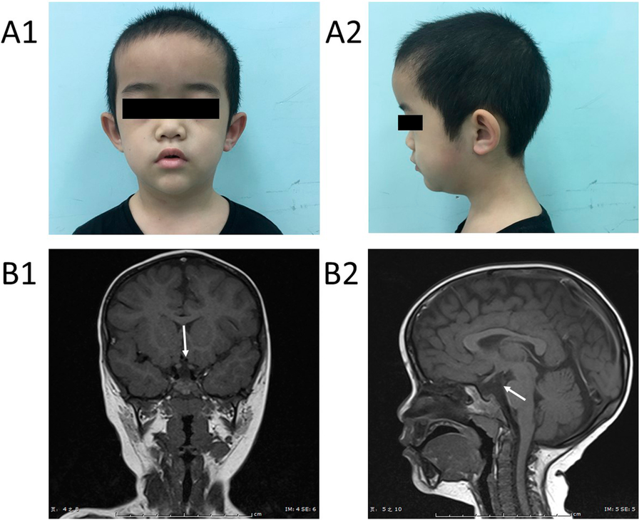 Fig. 1