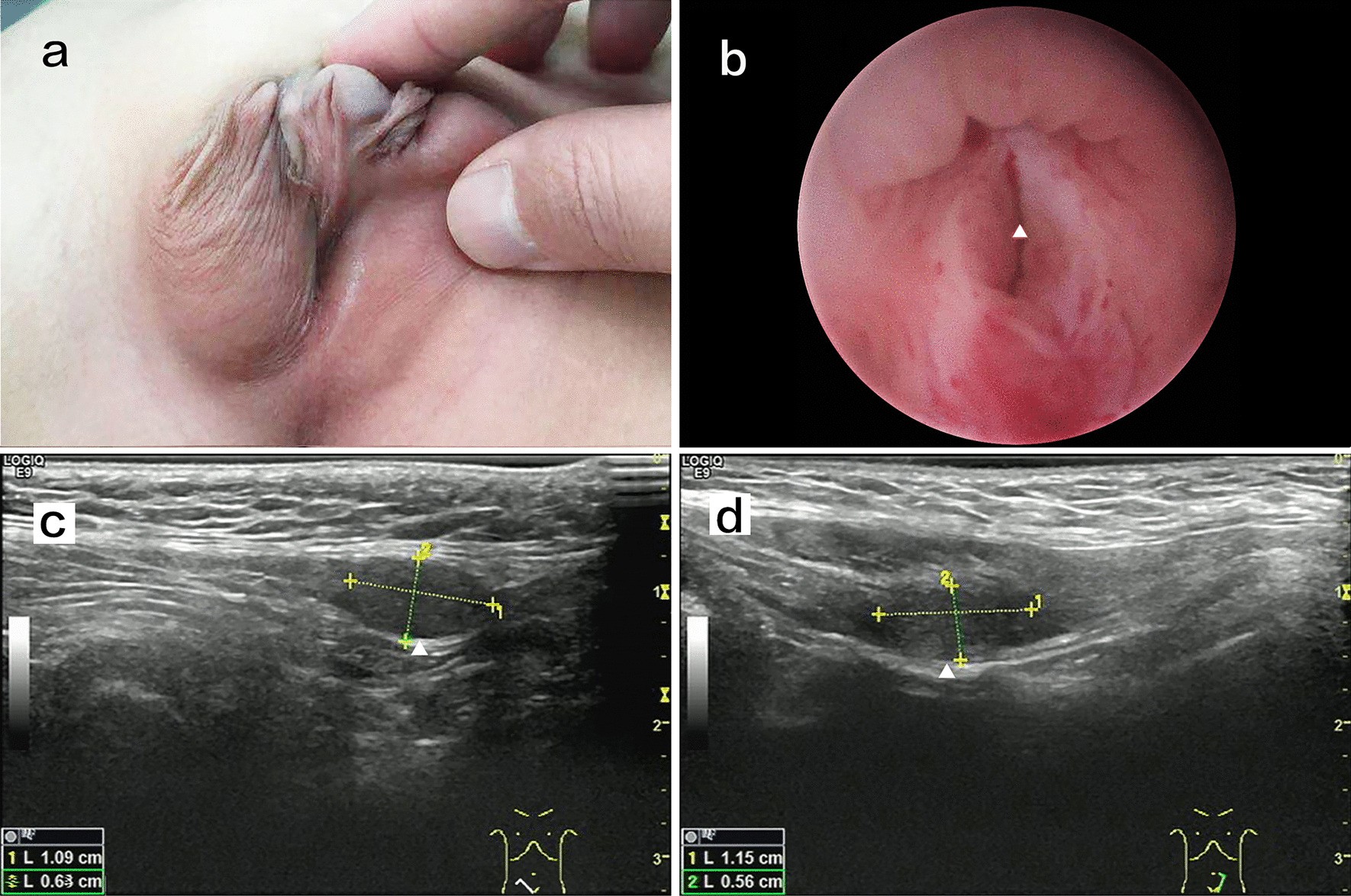 Fig. 1