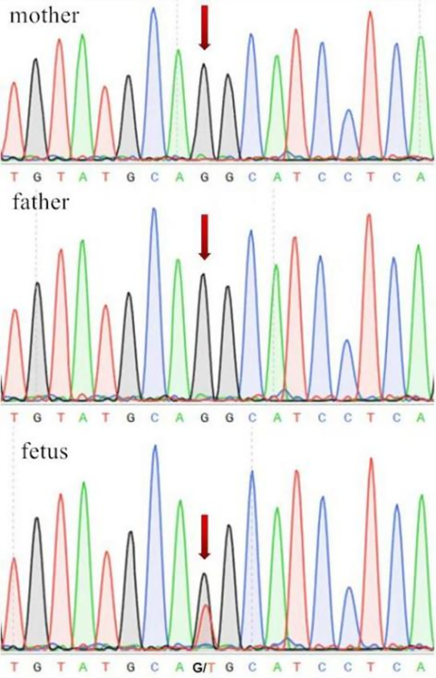 Fig. 1