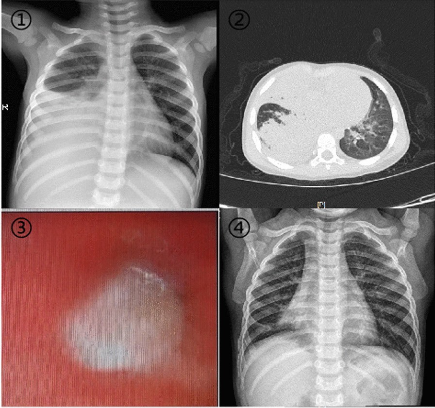 Fig. 1