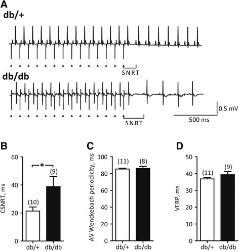 Sinoatrial node dysfunction arrhythmias in diabetic mice | Cardiovascular Diabetology |